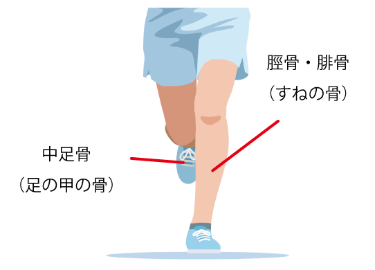 疲労骨折の起きやすい部位